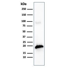 Western blot testing of human COLO-38 cell lysate with recombinant MART-1 antibody (clone MLANA/4475