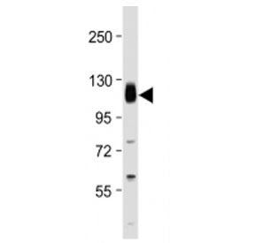 Thrombomodulin Antibody (C-Terminal Region)