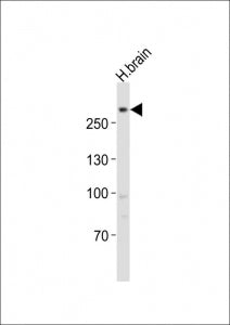 Western blot testing of LRRK2 antibody at 1:1000 dilution + human brain lysate