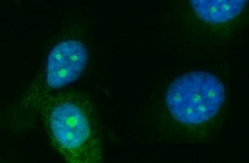 RRS1 Antibody / Ribosome biogenesis regulatory protein homolog
