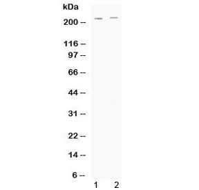 Western blot testing of human 1) HeLa and 2) A549 cell lysate with ABCC1 antibody at 0.5ug/ml. Predi