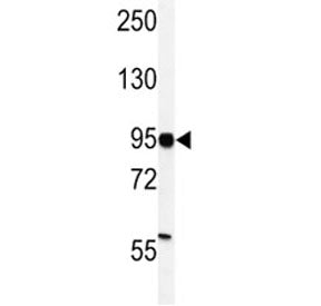 HIF-1 alpha Antibody