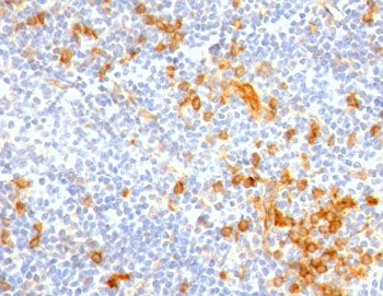 IL3RA Antibody / CD123