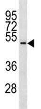 TUBD1 Antibody (Tubulin delta 1)