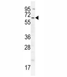 cIAP2 Antibody