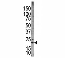 Western blot testing of Bim antibody and HL-60 cell lysate. Predicted molecular weight: 12-22 kDa (t