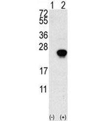 FGF1 Antibody