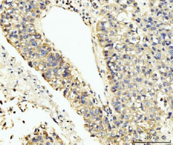 LARP4B Antibody / La-related protein 4B