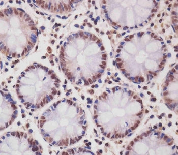 SMAD1 Antibody