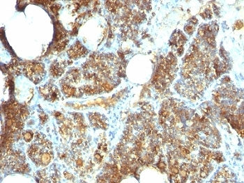 Parathyroid Hormone Antibody / C Terminal