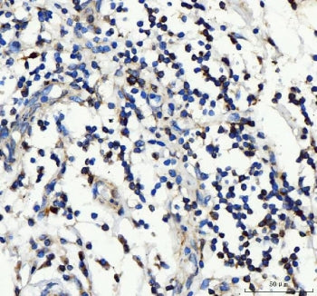 IL2RA Antibody