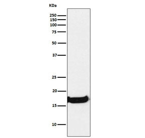 Uteroglobin Antibody / SCGB1A1