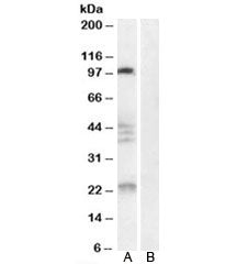 Nogo 66 receptor Antibody