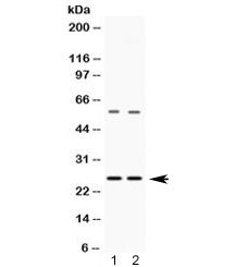 Western blot testing of 1) rat liver and 2) HeLa lysate with VAMP7 antibody at 0.5ug/ml. Expected mo