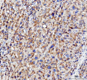 NUDT6 Antibody / Nucleoside diphosphate-linked moiety X motif 6