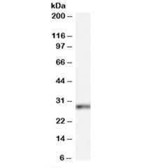 HOXB13 Antibody