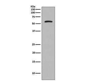 Western blot testing of human SH-SY5Y cell lysate with Tau antibody. Expected molecular weight: 50-8