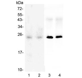 SNAP25 Antibody