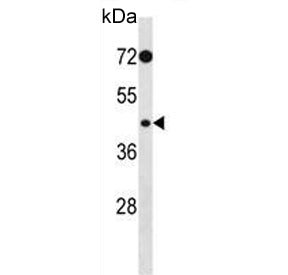 PHKG2 Antibody