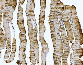 IHC staining of FFPE human skeletal muscle tissue with DOCK4 antibody. HIER: boil tissue sections in
