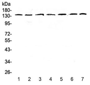 EIF2AK3 Antibody / PERK