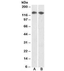 DBC1 Antibody