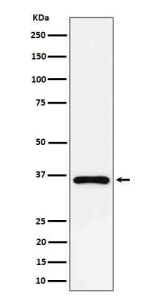 Western blot analysis of GAS2 expression in human Jurkat cell lysate using GAS2 antibody. Predicted