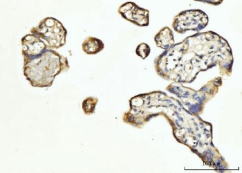 IHC staining of FFPE human placental tissue with FGF3 antibody. HIER: boil tissue sections in pH8 ED
