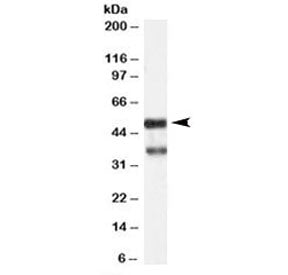 Western blot testing of human hippocampus lysate with PACSIN1 antibody at 1ug/ml. Predicted/observed