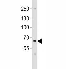 Western blot analysis of lysate from SK-N-MC cell line using PCSK9 antibody at 1:1000. Predicted siz