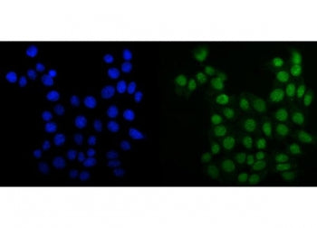 MCM6 Antibody