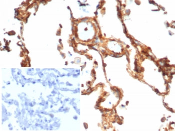 IHC staining of FFPE human lung tissue with Vinculin antibody (clone rVCL/7287). Inset: PBS used in