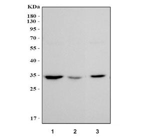 MAPRE1 Antibody / EB1