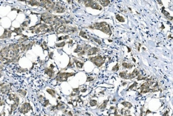 eRF1 Antibody / EFT1