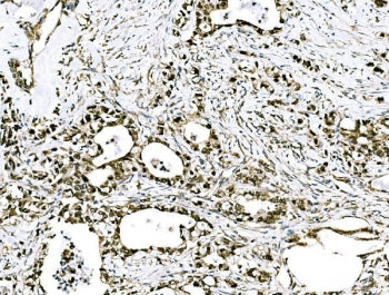 GRHL2 Antibody / Grainyhead-like protein 2 homolog