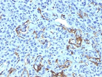 NGF Receptor Antibody Cocktail / p75NTR / CD271
