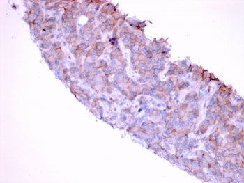 EGF Receptor / EGFR Antibody
