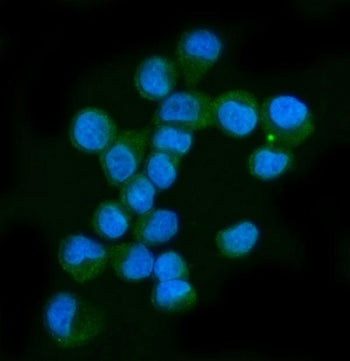 Immunofluorescent staining of FFPE human T-47D cells with NF1 antibody (green) and DAPI nuclear stai