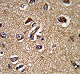 UNRIP Antibody / STRAP