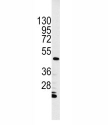Integrin linked kinase Antibody