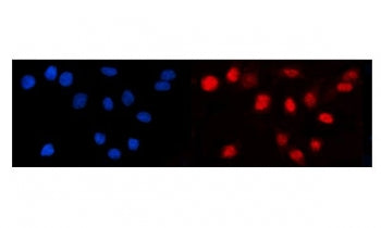 LEF1 Antibody / Lymphoid enhancer-binding factor 1 / TCF1 alpha