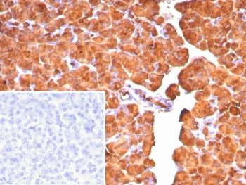 IHC staining of FFPE human pancreas tissue with Carboxypeptidase A1 antibody (clone CPA1/8777). Inse