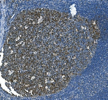 IHC staining of FFPE human tonsil with MCM2 antibody. HIER: boil tissue sections in pH8 EDTA for 20