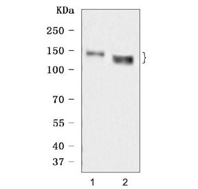 Western blot testing of human 1) A431 and 2) HACAT cell lysate with Desmoglein 3 antibody. Predicted
