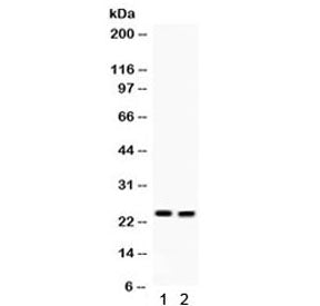Western blot testing of 1) mouse lung and 2) mouse intestine lysate with LCN2 antibody. Predicted/ob