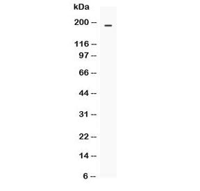 Western blot testing of human COLO320 cell lysate with MRP4 antibody at 0.5ug/ml. Predicted molecula