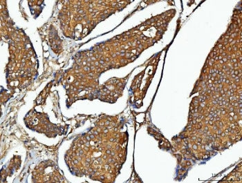 EEF2 Antibody / Elongation factor 2