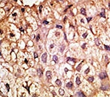 ACE2 Antibody