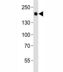 Western blot analysis of lysate from mouse liver tissue using Egfr antibody diluted at 1:1000. Expec