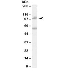 NOD2 Antibody